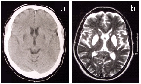 Figure 1. a.