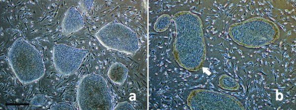 Colonies before (a) and after collagenase treatment (b)