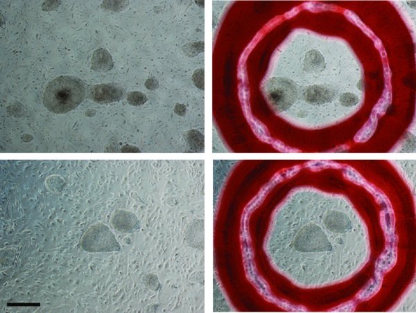 Marking plates; Top row; mark undifferentiated areas with the colony marker if PTK is to be used