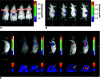 Figure 1.. Noninvasive molecular imaging of transplanted hPSCs.