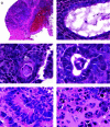 Figure 3.. Histological characterization of an explanted intramyocardial teratoma formed from undifferentiated mouse ESCs.