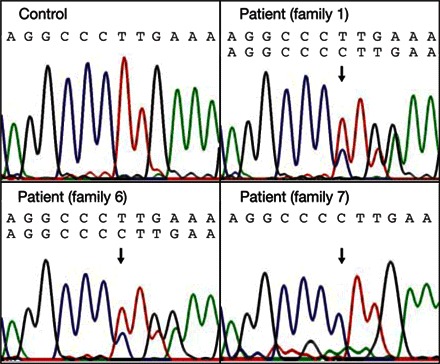 DNA sequence electropherograms of the NOD2 gene.