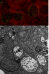 Chlamydia trachomatis inclusions in infected cells.