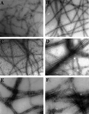 Salmonella SipA interacts with T-plastin to accelerate the bundling of actin filaments.