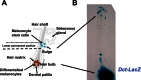 Figure 4. Localization of melanocyte stem cells in the hair follicle.