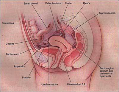 Figure 1. Common locations of endometriosis within the pelvis and abdomen.