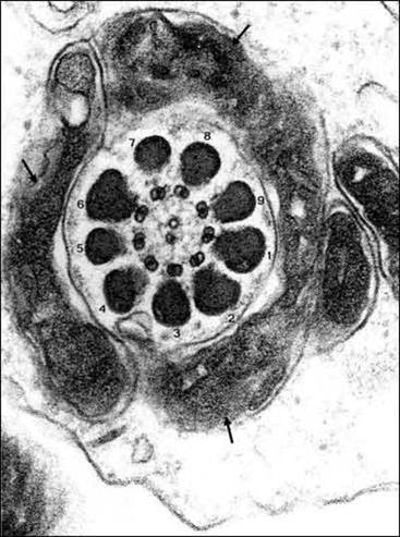 Figure 8. A cross-section through the developing mid-piece of the sperm tail shows the aggregation of mitochondria (arrows) surrounding the outer dense fibres (labelled 1-9) which in turn surround the axoneme composed of 9 doublet microtubules surrounding two central microtubules. Reproduced with permission from "Visual atlas of human sperm structure and function for assisted reproductive technology" Ed A.H. Sathanathan 1996.