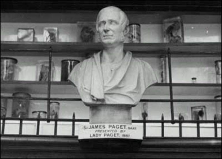 Figure 1. . The bust of Sir James Paget in the Museum of St.