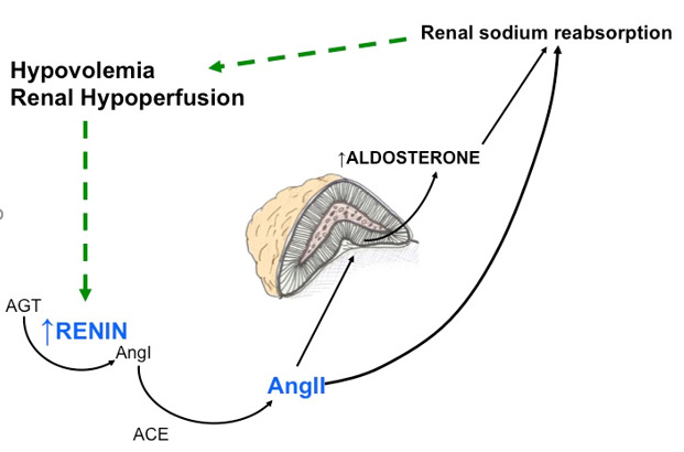 Figure 1. . Renin-Dependent Aldosteronism.
