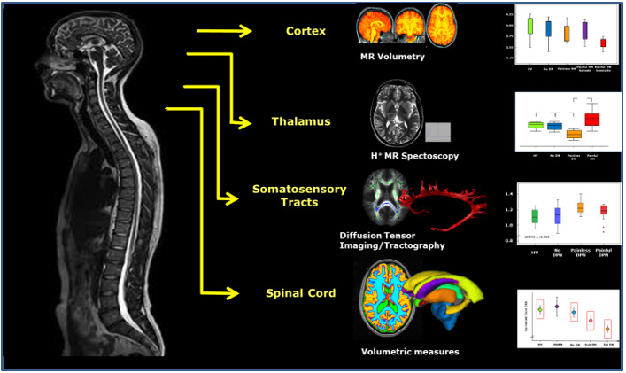 Figure 12. . Multimodal magnetic resonance imaging studies of the central nervous system in diabetic neuropathy.