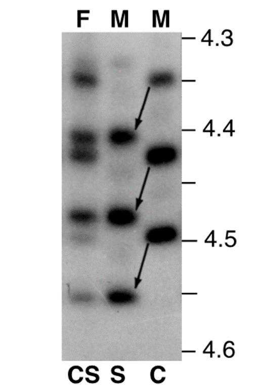 Figure 4. . Microheterogeneity of TBG.