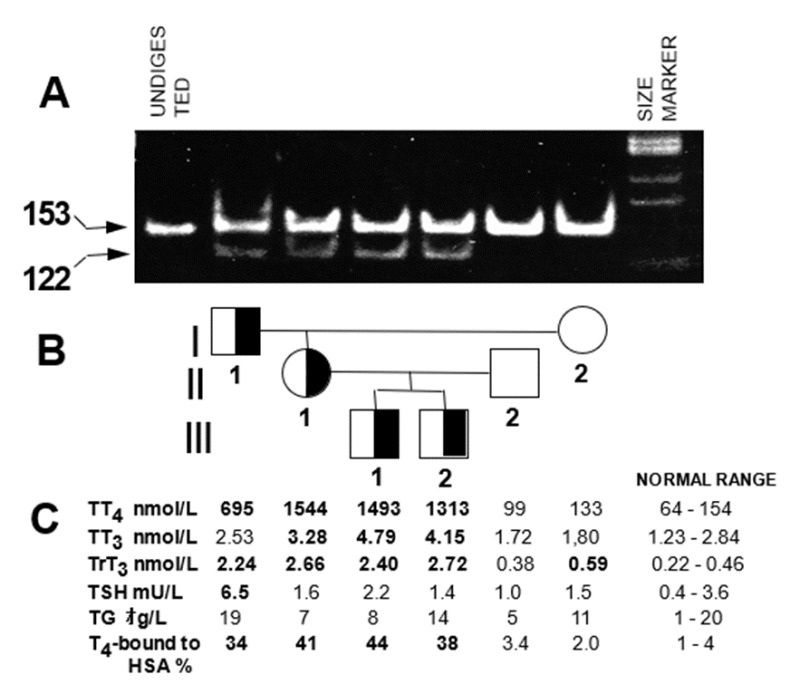 Figure 5. . A Swiss family with HSA R218P: genotyping, pedigree and thyroid function tests.