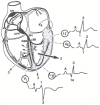 Figure 33.8. Sequence of activation of the heart, with resultant vectors.