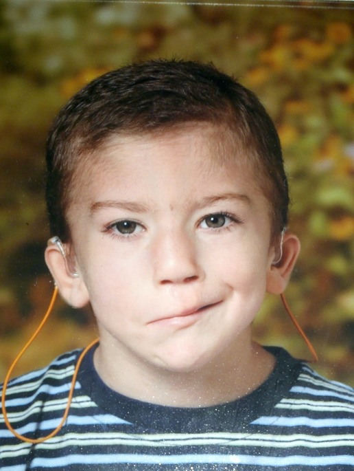 Figure 1. . Photo of a boy age five years with branchiooculofacial syndrome syndrome (BOFS).