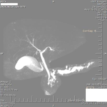 Figure 6. . Maximum Intensity Projection Image showing irregular dilatation of main pancreatic duct with calculi within.