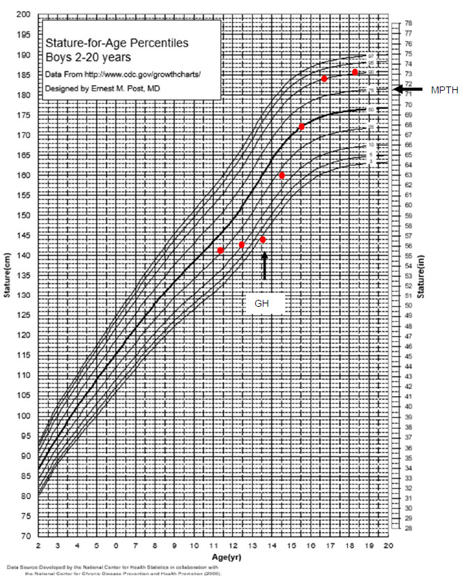 Figure 2. . Patient 2 growth chart: Longitudinal growth chart in patient 2 before and after growth hormone therapy.