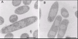 Figure 4. Appearance of the nucleoids of E.