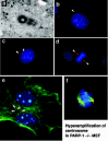 Figure 2. Hyperamplification of the centrosome in PARP-1 -/- mouse embryonic fibroblasts.