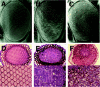 Figure 5. Genetic interaction of PARP with small GTPase, RhoA.