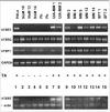 Figure 5. Representative results of RT-PCR analysis for the expression of genes of telomerase subunits in mesothelium-derived cells and tissues.