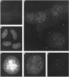 Figure 6. Single immunofluorescence with the L20 antibody (a, b, c), and in combination with FISH with a PNA telomere probe (e, f), visualizing the presence of nuclear speckles in both HeLa cells (a), fibroblasts (b) and mesothelial cells (c), but absence of colocalization of L20 signals (red) and telomeres (green) as demonstrated in mesothelioma cells (e) and HeLa cells (f).