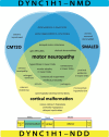 Figure 1. . Venn diagram provides an overview of key phenotypes and clinical entities in DYNC1H1-related neuromuscular disorder (DYNC1H1-NMD; indicated in blue) and DYNC1H1-related neurodevelopmental disorder (DYNC1H1-NDD; indicated in yellow).