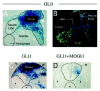 Figure 2. Induction of tumors by misexpressed GLI1.