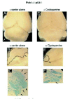 Figure 7. Beneficial anti-cancer effects of systemic in vivo cyclopamine treatment in mice.