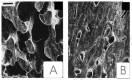 Figure 15. A striking demonstration of the potent ability of hPTH-(1-31)NH2 (Ostabolin™ ) to strongly stimulate trabecular growth in a rat femur.