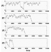 Figure 9. Double feedback results in a pseudo-bistable system in which gene product concentrations fluctuate with relatively low amplitude at a high level with occasional large excursions.