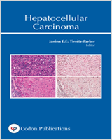 Cover of Hepatocellular Carcinoma